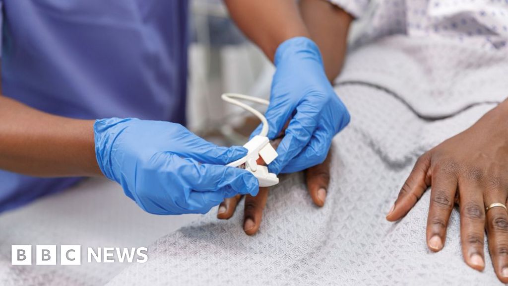 Nurses in Scotland to strike after rejecting pay deal from NHS