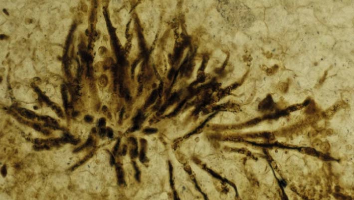 407-Million-Years-Old Microfossils Reveal Earliest-Known Disease-Causing Fungus